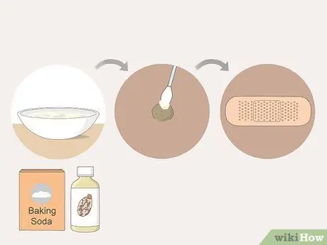 Get Rid of Warts Step 33