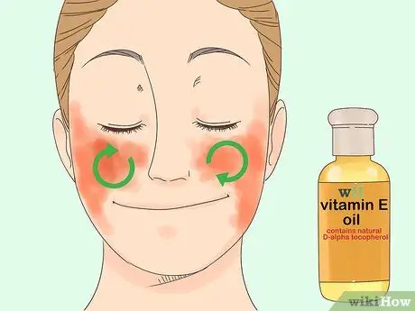 Traiter l'eczéma du visage Étape 14