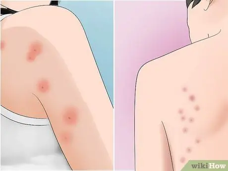 Avoid Insect Bites While Sleeping Step 1