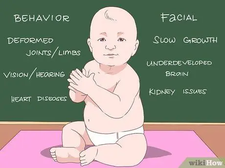 Recognize Fetal Alcohol Syndrome Step 2