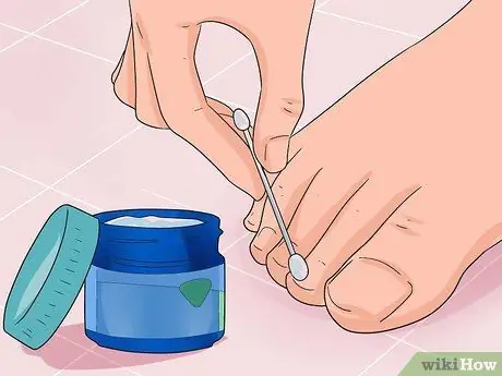 Cure Nail Fungus Step 5