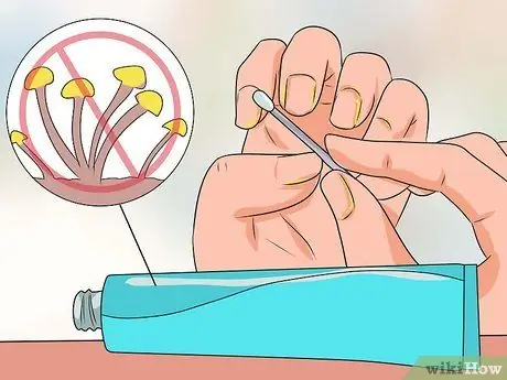 Cure Nail Fungus Step 7