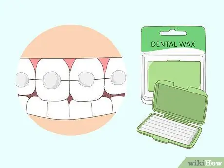 Kiss With Braces Langkah 9