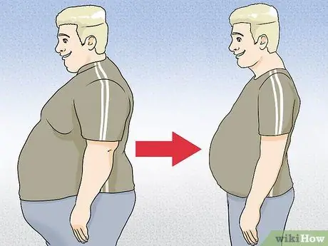 Overcome Obesity Step 20