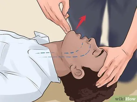 Do Basic First Aid Step 8