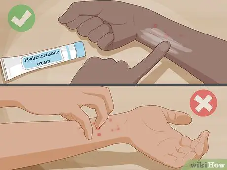 Get Rid of Chiggers Step 10