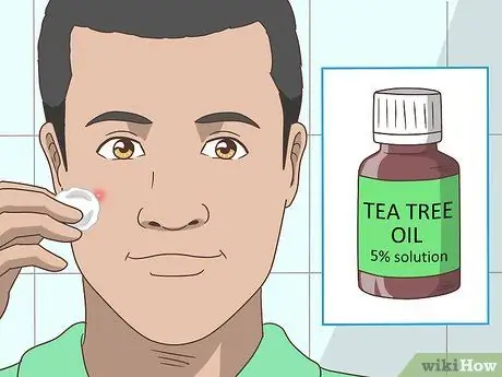 Get Rid of a Pimple Step 10