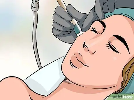 Fade Acne Scars Step 11