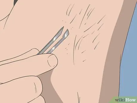 Reduce Body Hair Growth Step 13