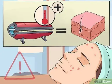 Cuide de sua pele depois de usar uma cama de bronzeamento artificial Passo 20