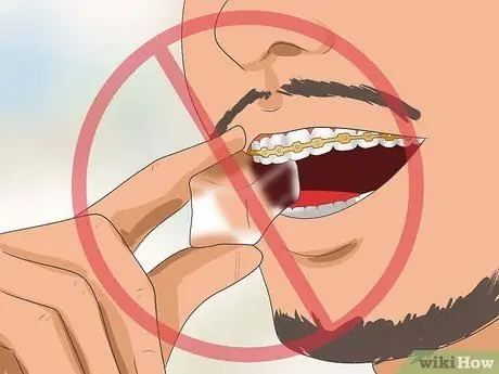 Get Your Braces off Faster Step 10