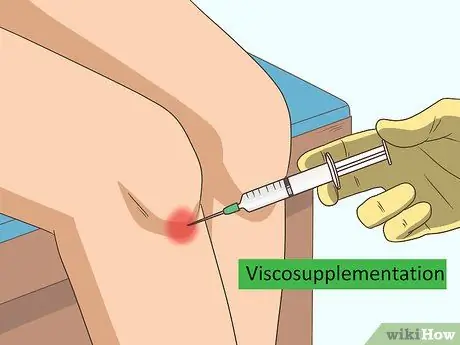 เพิ่ม Synovial Fluid ขั้นตอนที่ 19