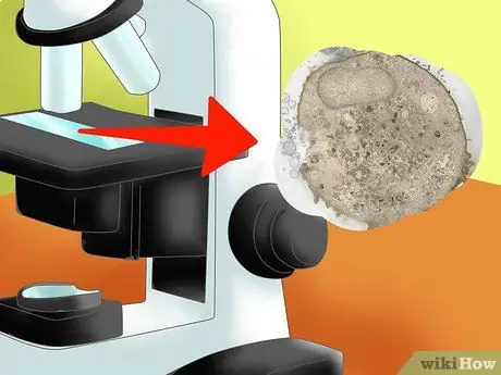 Eleza tofauti kati ya Prokaryotes na Eukaryotes Hatua ya 5